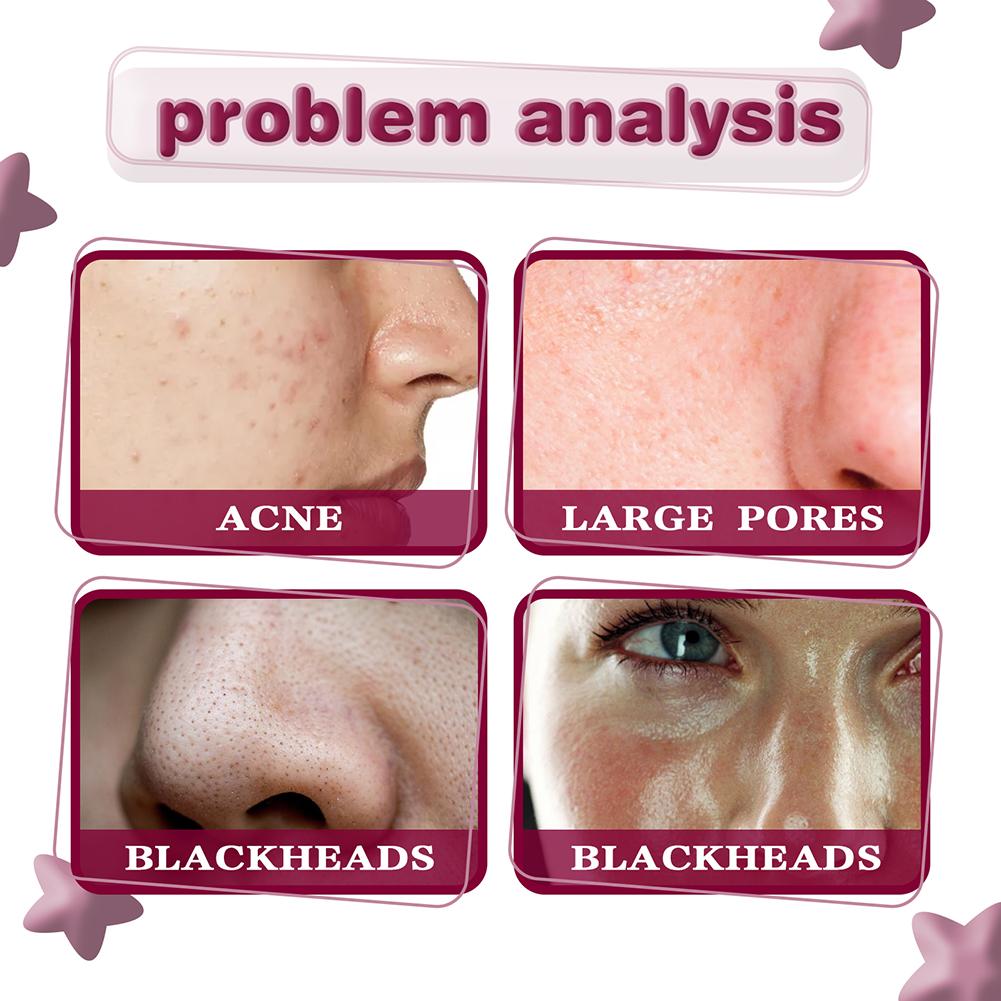 Serum anti-acné / anti-manchas JAYSUING