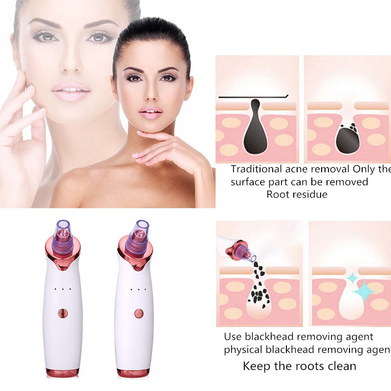 Limpiador de poros por succión – Eliminación de Impurezas Facial