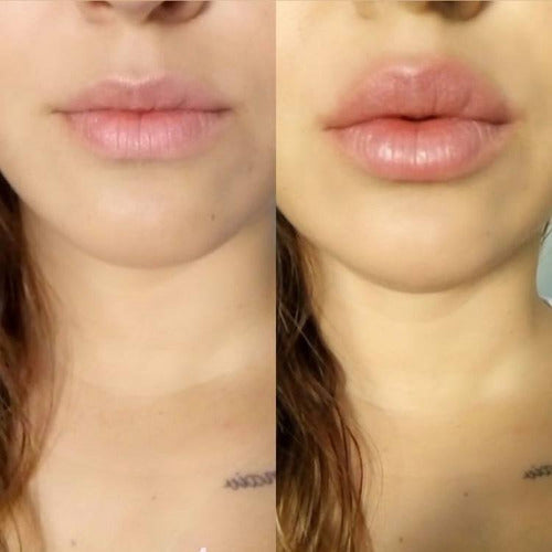 Voluminizador de labios  KissMe™