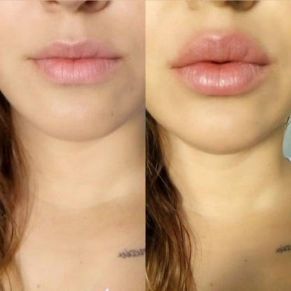 Voluminizador de labios  KissMe™